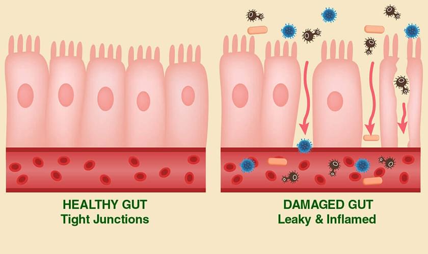 What lectins do to our gut